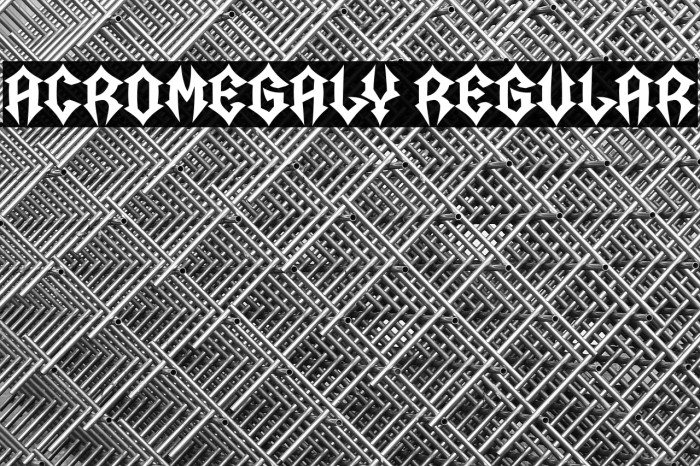 Acromegaly Regular Example 1