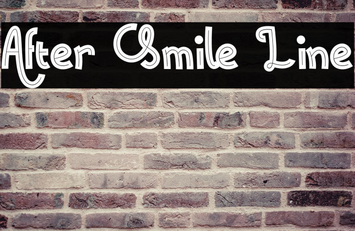 After Smile Line Example 1