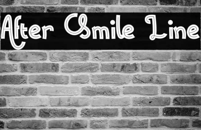 After Smile Line Example 1