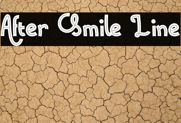 After Smile Line Example 2