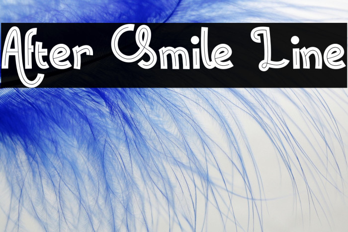 After Smile Line Example 3