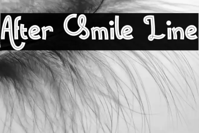 After Smile Line Example 3