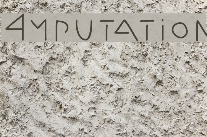 Amputation Example 2