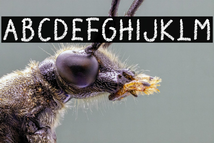 Chalk Perio Example 3