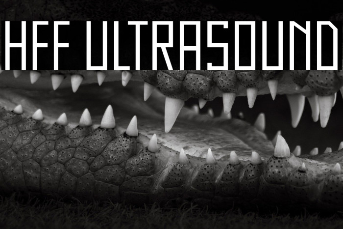 HFF Ultrasound Example 3