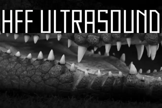 HFF Ultrasound Font examples