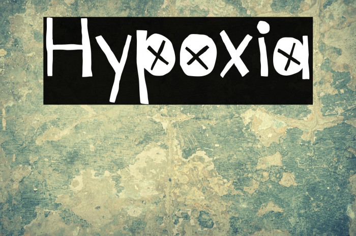 Hypoxia Example 2