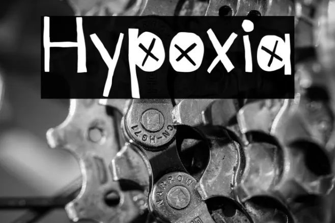 Hypoxia Example 3