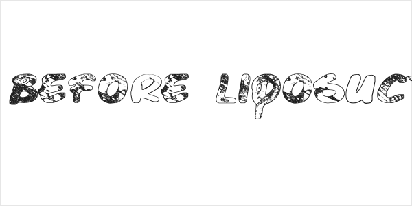 Just Before Liposuction Logo