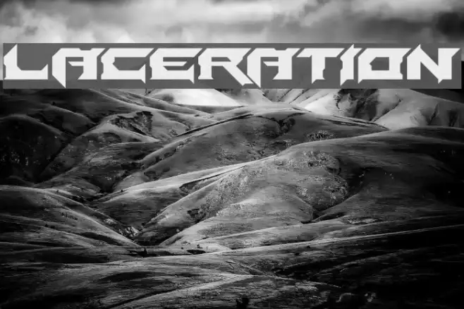 Laceration Example 3