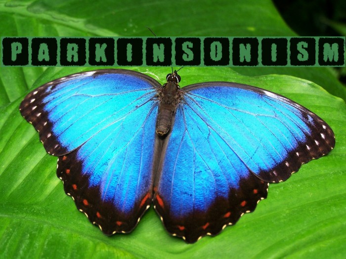 Parkinsonism Example 2