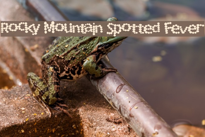 Rocky Mountain Spotted Fever Font examples