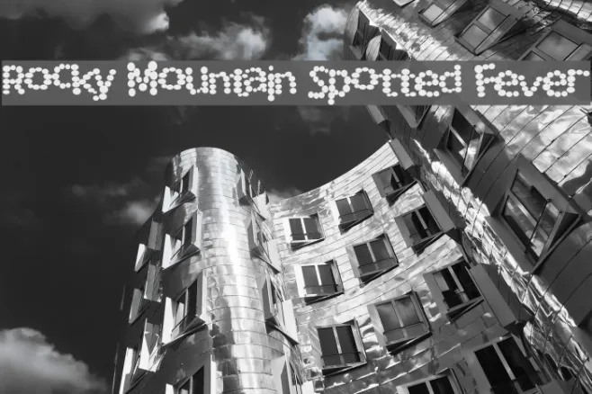 Rocky Mountain Spotted Fever Example 3