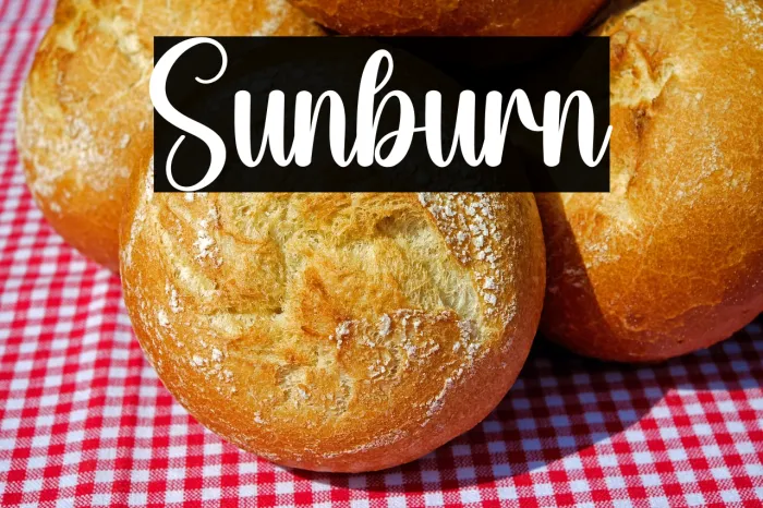 Sunburn Example 2