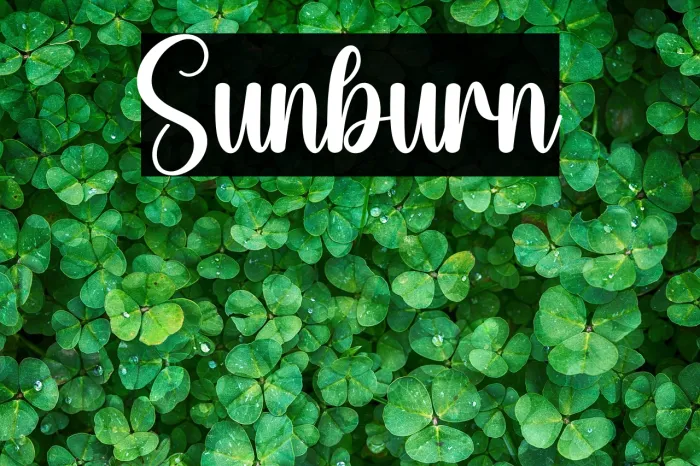 Sunburn Example 3
