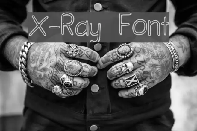 X-Ray Example 1